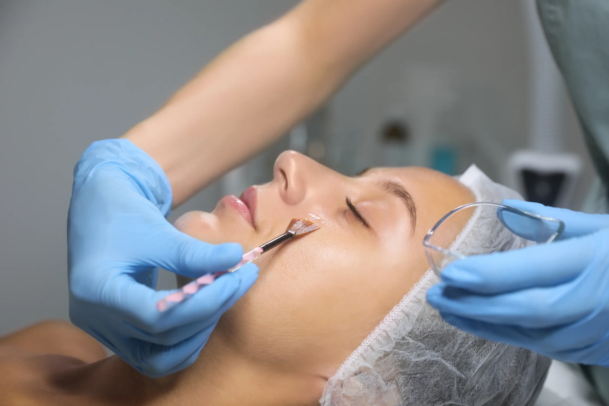L’Art du Peeling pour une Peau Zéro Défaut