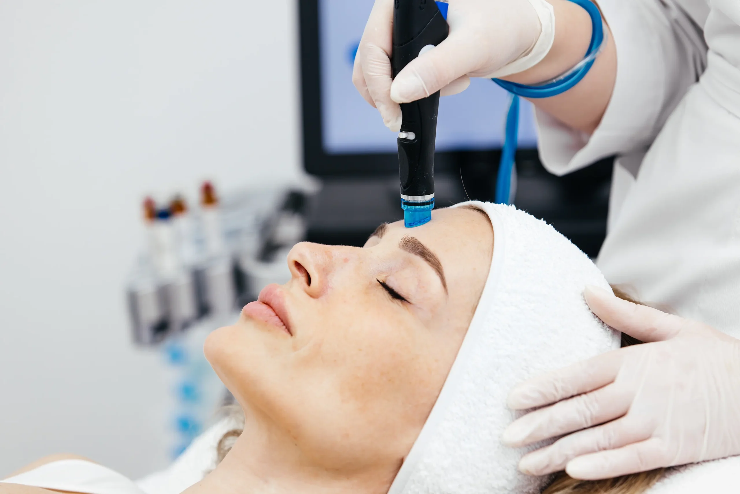 Hydrafacial Anti-Imperfections : L’Arme Fatale Contre les Pores dilatés et les Boutons