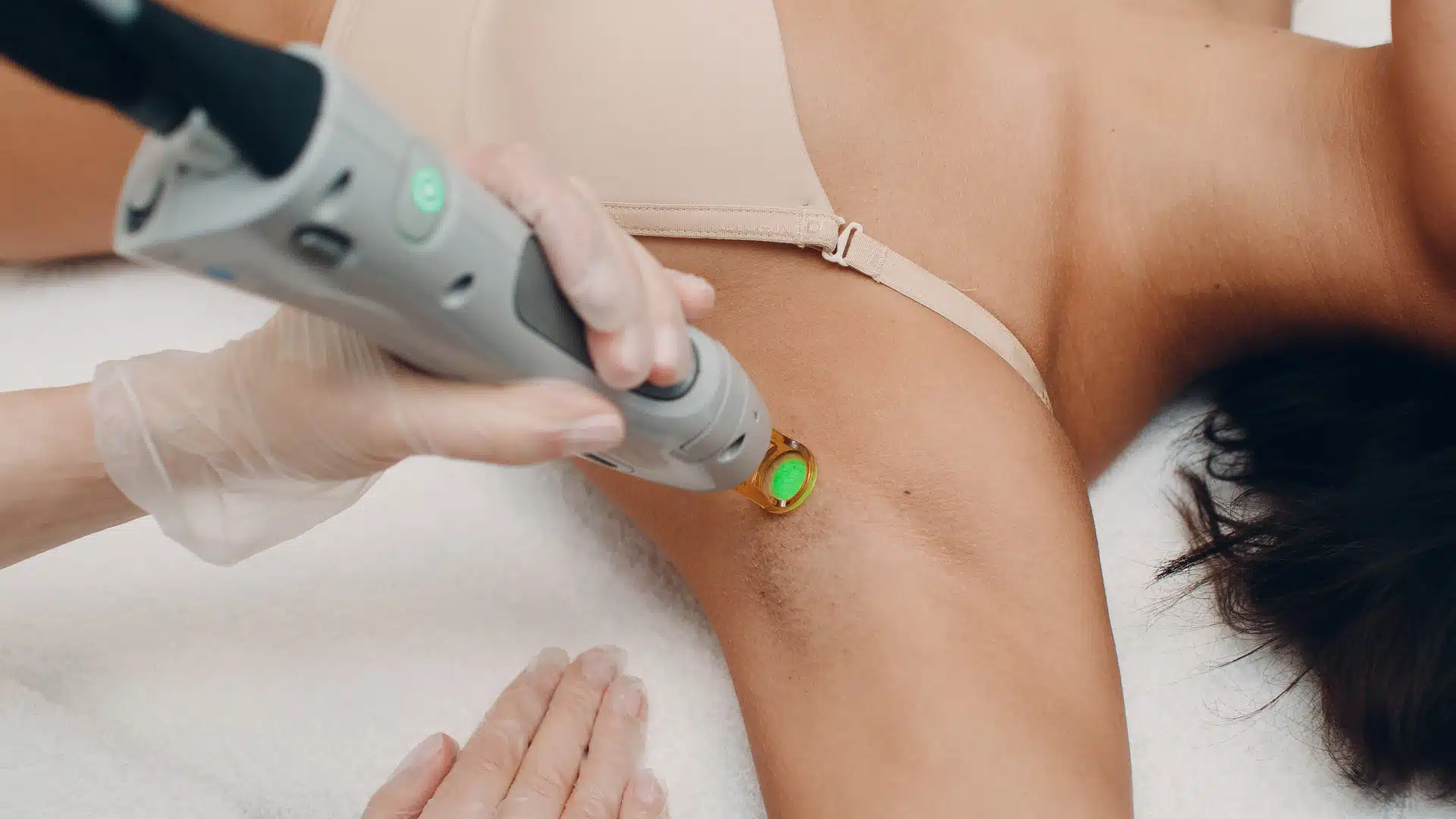 Laser Alexandrite et Laser Nd:YAG : Guide Complet pour une Épilation Laser Médicale Efficace