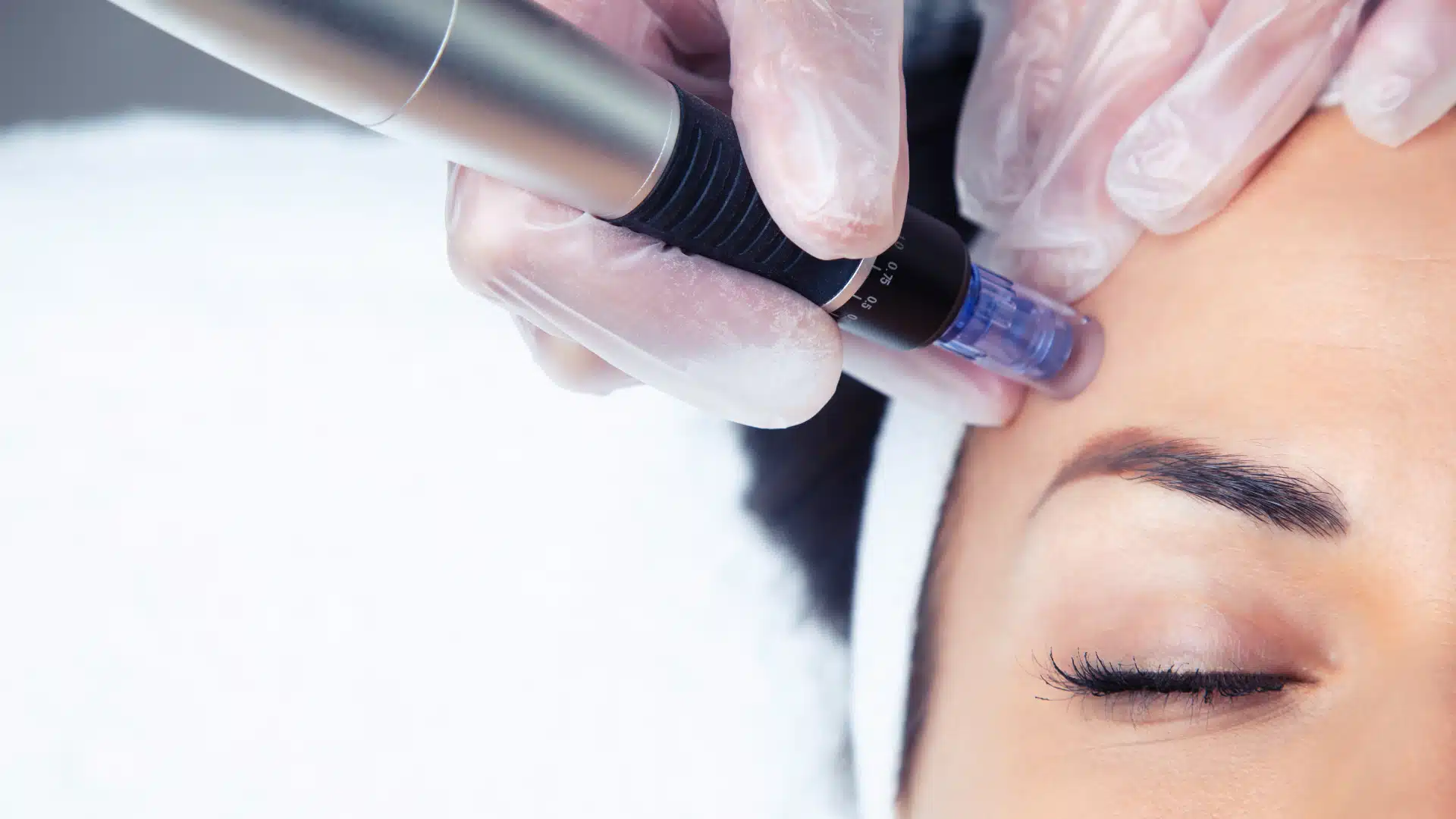 Le Mesopen visage : le soin incontournable pour une peau régénérée