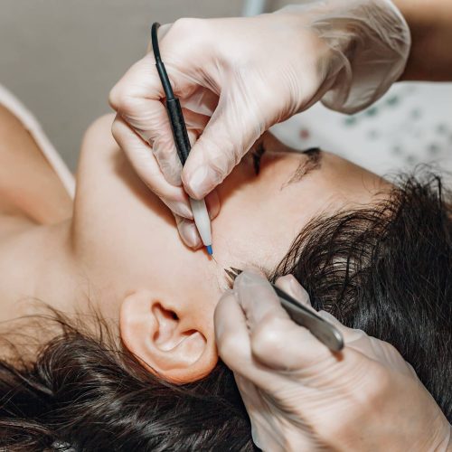 Female,Cosmetologist,Performs,The,Procedure,Of,Permanent,Removal,Of,Unwanted